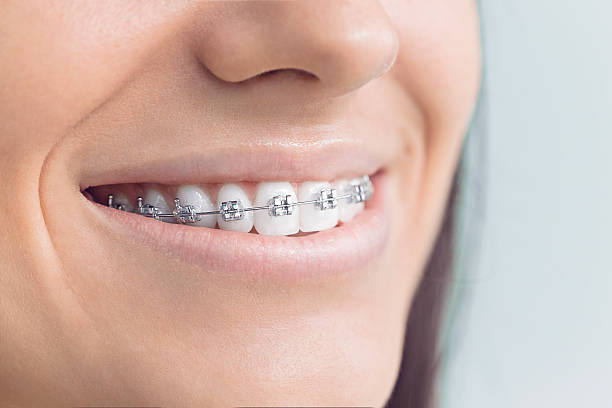 Best Invisalign and Clear Aligners  in Cuyahoga Falls, OH